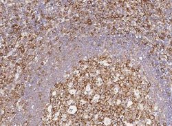 CCR1 Rabbit anti-Human, Clone: 3, Novus Biologicals 50 &mu;g; Unconjugated:Antibodies,