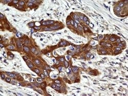 CCR2 Antibody (3G7) - Azide and BSA Free, Novus Biologicals 0.1 mg; Unconjugated:Antibodies,