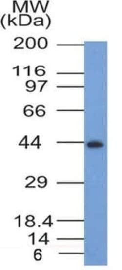 CCR2 Antibody (3G7) - Azide and BSA Free, Novus Biologicals 0.1 mg; Unconjugated:Antibodies,
