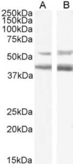 CCR4 Antibody (KW-0761 (Mogamulizumab)) - Chimeric - Azide and BSA Free, Novus Biologicals 0.025 mg | Buy Online | Novus Biologicals | Fisher Scientific