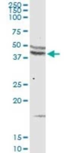 CCR5 Antibody, Novus Biologicals 0.1 mg | Buy Online | Novus Biologicals | Fisher Scientific