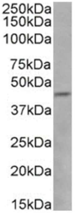 CCR5 Rabbit anti-Human, Clone: V14/2, Novus Biologicals 0.025 mg; Unconjugated:Antibodies,