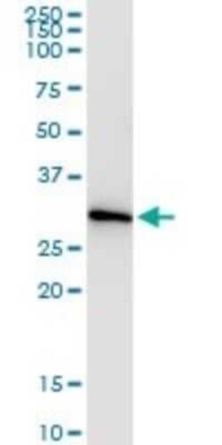 CCS/SOD4 Antibody (1E2), Novus Biologicals 0.1 mg | Buy Online | Novus Biologicals | Fisher Scientific