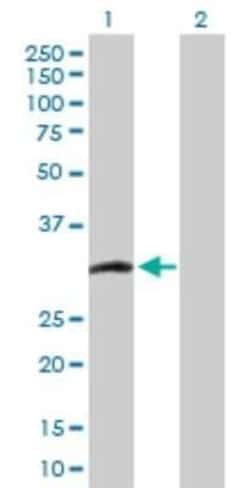 CCS/SOD4 Antibody, Novus Biologicals 0.1 mg | Buy Online | Novus Biologicals | Fisher Scientific