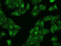 CCT3 Antibody, Novus Biologicals 100 &mu;g | Buy Online | Novus Biologicals | Fisher Scientific