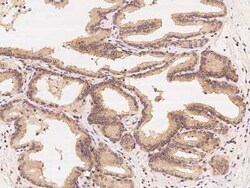 CCT3 Antibody, Novus Biologicals 100 &mu;g; Unconjugated:Antibodies, Polyclonal
