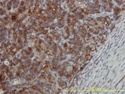 CCT5 Antibody (4E5-4B1), Novus Biologicals 0.1 mg | Buy Online | Novus Biologicals | Fisher Scientific