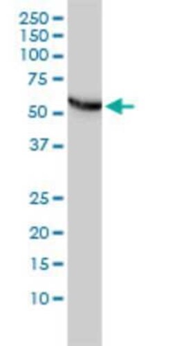 CCT5 Antibody (4E5-4B1), Novus Biologicals 0.1 mg | Buy Online | Novus Biologicals | Fisher Scientific