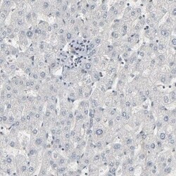 CCT5 Antibody, Novus Biologicals 0.1 mL | Buy Online | Novus Biologicals | Fisher Scientific