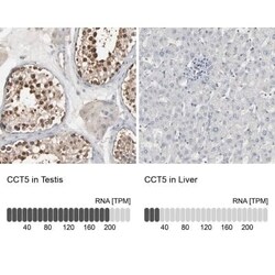 CCT5 Antibody, Novus Biologicals 0.1 mL | Buy Online | Novus Biologicals | Fisher Scientific