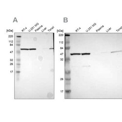 CCT5 Antibody, Novus Biologicals 0.1 mL | Buy Online | Novus Biologicals | Fisher Scientific