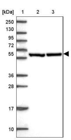 CCT6A Antibody, Novus Biologicals 0.1 mL, Unconjugated:Antibodies, Polyclonal