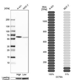 CCT6A Antibody, Novus Biologicals 0.1 mL, Unconjugated:Antibodies, Polyclonal