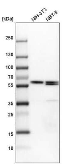 CCT6A Antibody, Novus Biologicals 0.1 mL, Unconjugated:Antibodies, Polyclonal