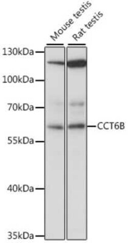 CCT6B Antibody - Azide and BSA Free, Novus Biologicals 0.1 mL, Unconjugated:Antibodies,