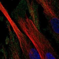 CD109 Rabbit anti-Human, Polyclonal, Novus Biologicals 25 &mu;g; Unconjugated:Antibodies,