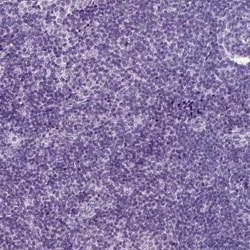 CD109 Antibody, Novus Biologicals 25ul; Unconjugated:Antibodies, Polyclonal