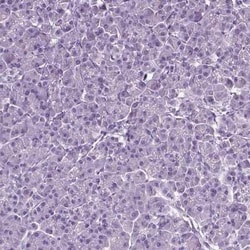 CD109 Antibody, Novus Biologicals 25ul; Unconjugated:Antibodies, Polyclonal