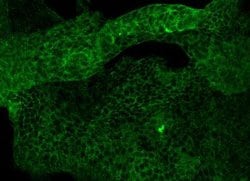 CD117/c-kit Rabbit anti-Human, Clone: 7, Novus Biologicals:Antibodies:Primary