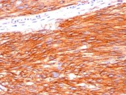 CD117/c-kit Antibody (C117/370), Novus Biologicals:Antibodies:Primary Antibodies