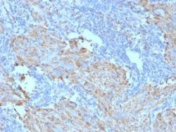 CD117/c-kit Antibody (C117/370), Novus Biologicals:Antibodies:Primary Antibodies
