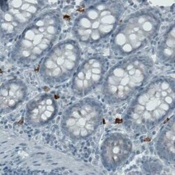 CD117/c-kit Antibody (CL1657), Novus Biologicals 25 &mu;L, Unconjugated:Antibodies,