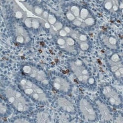 CD117/c-kit Antibody (CL1657), Novus Biologicals 25 &mu;L, Unconjugated:Antibodies,