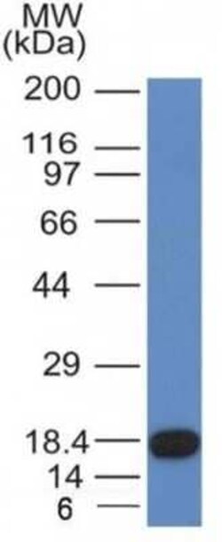 CD117/c-kit Antibody (KIT/982), Novus Biologicals 0.02mg; Unlabeled:Antibodies,