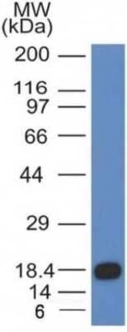 CD117/c-kit Antibody (KIT/983), Novus Biologicals:Antibodies:Primary Antibodies