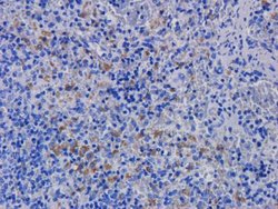 CD11a/CD18 Antibody (hu1124 (Efalizumab)) - Azide and BSA Free, Novus Biologicals