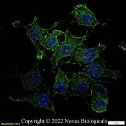 CD11b Antibody (M1/70.15) - BSA Free, Novus Biologicals 0.1mg; Unlabeled:Antibodies,