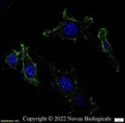 CD11b Antibody (M1/70.15) - BSA Free, Novus Biologicals 0.1mg; Unlabeled:Antibodies,