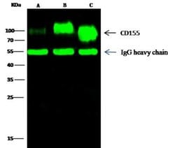 CD155/PVR Rabbit anti-Human, Clone: 114, Novus Biologicals 50 &mu;g; Unconjugated:Antibodies,