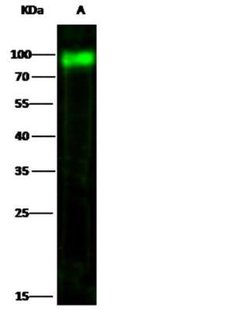 CD155/PVR Rabbit anti-Human, Clone: 114, Novus Biologicals 50 &mu;g; Unconjugated:Antibodies,