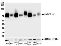 CD155/PVR Antibody (BLR074G), Novus Biologicals 100 &mu;L; Unconjugated:Antibodies,