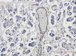 CD155/PVR Antibody (S04-2C7), Novus Biologicals:Antibodies:Primary Antibodies