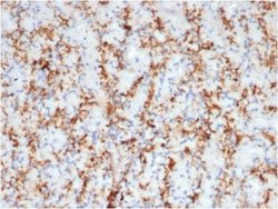 CD163 Rabbit anti-Human, Clone: M130/3708R, Novus Biologicals:Antibodies:Primary