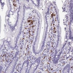 CD163 Antibody, Novus Biologicals 25 &mu;L, Unconjugated:Antibodies, Polyclonal