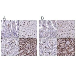 CD163 Antibody, Novus Biologicals 25 &mu;L, Unconjugated:Antibodies, Polyclonal