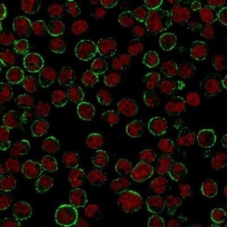 CD19 Antibody (CVID3/155), Novus Biologicals:Antibodies:Primary Antibodies