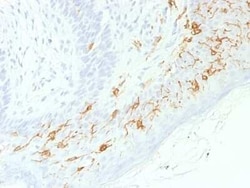 CD1a Antibody (C1A/1506R), Novus Biologicals 100&mu;g; Unlabeled:Antibodies,