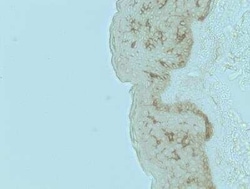 CD1a Antibody (O10) - Azide and BSA Free, Novus Biologicals 0.1 mg; Unconjugated:Antibodies,