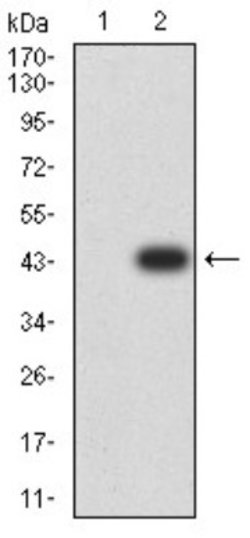 CD2 Antibody (3D1E3) - BSA Free, Novus Biologicals 0.1 ml; Unconjugated:Antibodies,