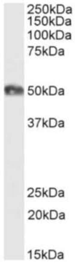 CD2, Rabbit anti-Human, Clone: YTH 655, Novus Biologicals:Antibodies:Primary