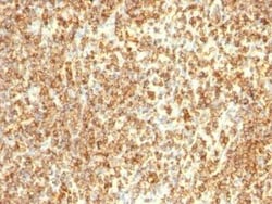 CD20 Antibody (L26 + IGEL/773), Novus Biologicals:Antibodies:Primary Antibodies