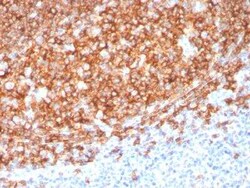 CD20 Antibody (MS4A1/3410) - Azide and BSA Free, Novus Biologicals 100