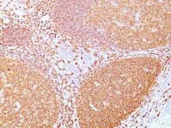 CD20 Antibody (rIGEL/773), Novus Biologicals:Antibodies:Primary Antibodies