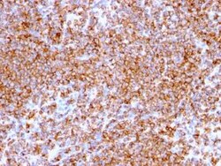 CD20 Antibody (rIGEL/773), Novus Biologicals:Antibodies:Primary Antibodies
