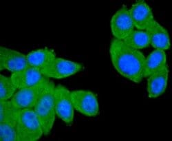 CD21 Antibody (SC0681), Novus Biologicals 100&mu;L:Antibodies, Monoclonal