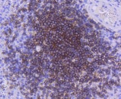 CD21 Antibody (SC0681), Novus Biologicals 100&mu;L:Antibodies, Monoclonal
